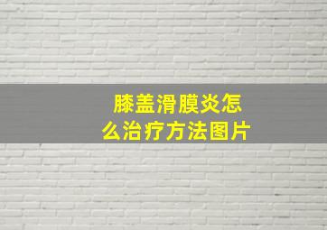 膝盖滑膜炎怎么治疗方法图片