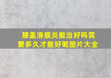 膝盖滑膜炎能治好吗需要多久才能好呢图片大全