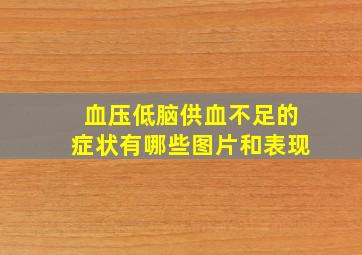 血压低脑供血不足的症状有哪些图片和表现