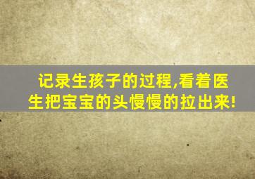 记录生孩子的过程,看着医生把宝宝的头慢慢的拉出来!