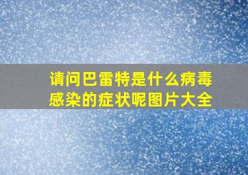 请问巴雷特是什么病毒感染的症状呢图片大全