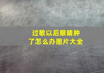 过敏以后眼睛肿了怎么办图片大全