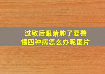 过敏后眼睛肿了要警惕四种病怎么办呢图片