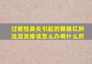 过敏性鼻炎引起的眼睛红肿流泪发痒该怎么办喝什么药