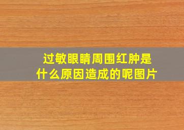 过敏眼睛周围红肿是什么原因造成的呢图片