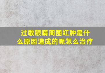 过敏眼睛周围红肿是什么原因造成的呢怎么治疗