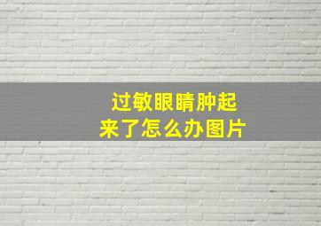 过敏眼睛肿起来了怎么办图片