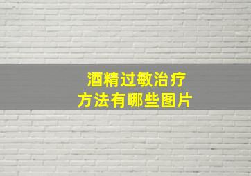 酒精过敏治疗方法有哪些图片