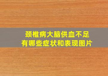 颈椎病大脑供血不足有哪些症状和表现图片