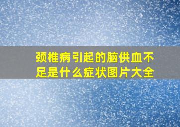 颈椎病引起的脑供血不足是什么症状图片大全