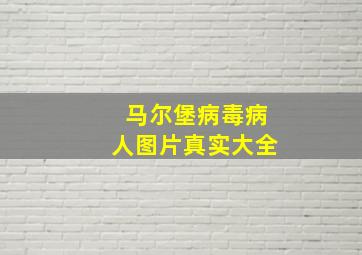 马尔堡病毒病人图片真实大全