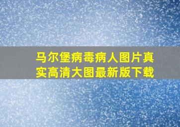 马尔堡病毒病人图片真实高清大图最新版下载