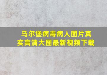 马尔堡病毒病人图片真实高清大图最新视频下载