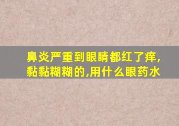 鼻炎严重到眼睛都红了痒,黏黏糊糊的,用什么眼药水