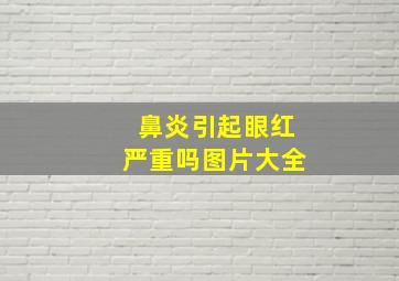 鼻炎引起眼红严重吗图片大全