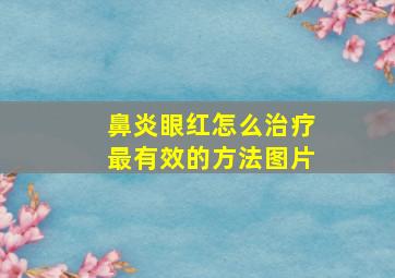 鼻炎眼红怎么治疗最有效的方法图片